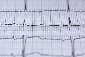 Badanie EKG w tężyczce